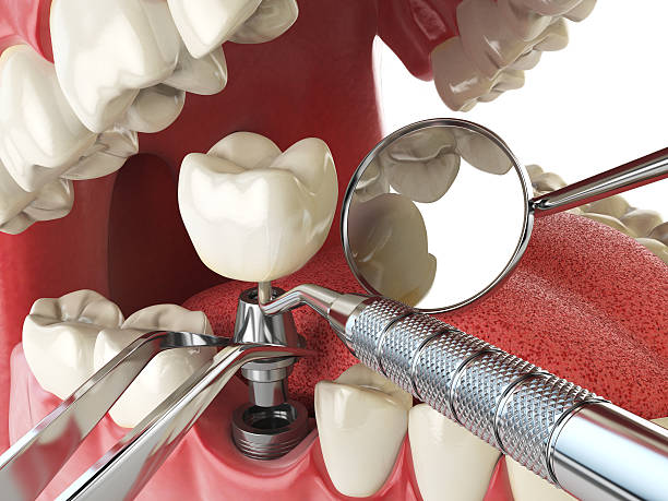 Best Weekend Emergency Dentist in Appomattox, VA